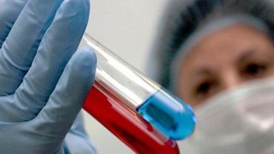 О проведении ряда исследований специалистами референтной лаборатории по особо опасным болезням ФГБУ «ВНИИЗЖ»