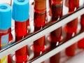 О проведении ряда исследований лабораторией по особо опасным болезням ФГБУ «ВНИИЗЖ»